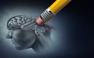 drawing of brain being erased
